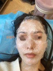 体验后-杭州米兰柏羽医疗美容医院