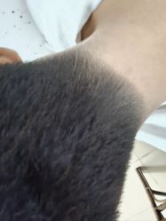 -碧莲盛·不剃发植发