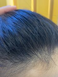 -熙朵美学植发·连锁品牌