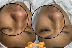 -海菲秀·飞顿牛奶光·LDM官方授权中心美轮美浣瓷感美肌