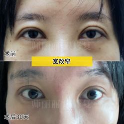 -丰联丽格医疗美容·联合丽格眼整形中心