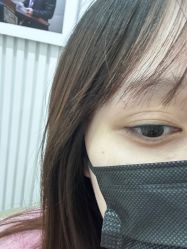 -广州健丽·去眼袋医疗美容机构