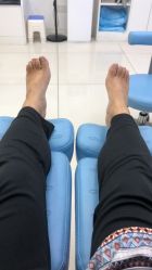 -派恩宜灰指甲鸡眼嵌甲手足癣