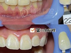 -精德口腔·种植修复·儿牙中心(财富中心店)