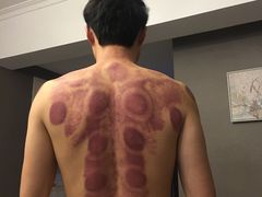 -太乙推拿馆(杨家湾店)