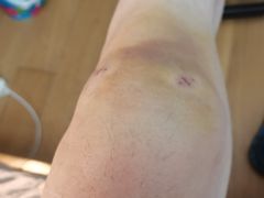 -复旦大学附属华山医院(浦东院区)