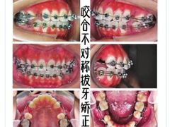 -团圆口腔·种植中心(锦江院区)
