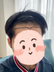 -大麦微针植发丨全国连锁