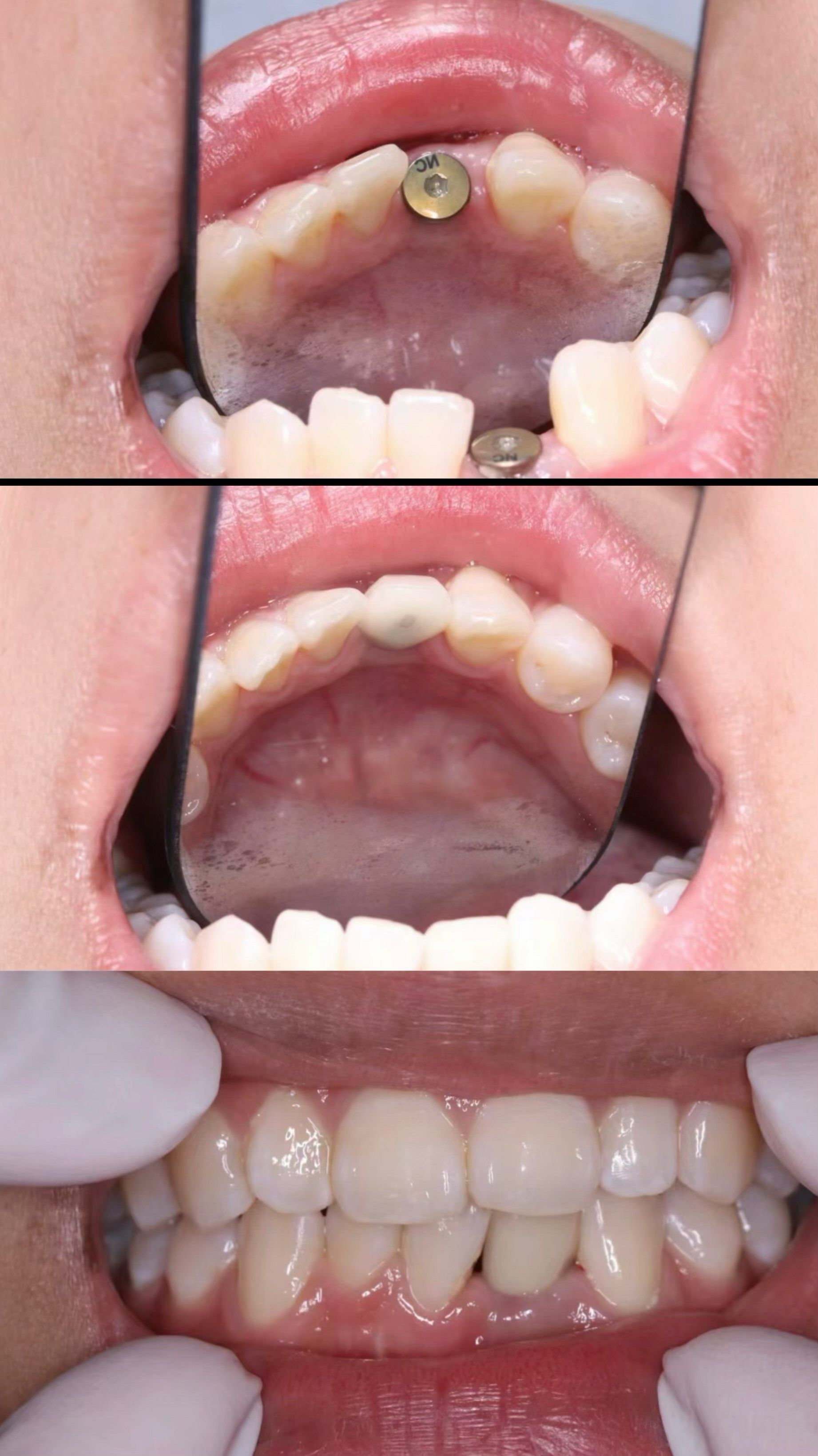 人才引智攀登高峰