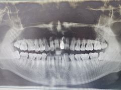 -北京大学口腔医院(第一门诊部)