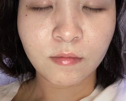 体验前-美莱医疗美容医院