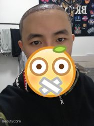 体验后-熙朵美学植发连锁