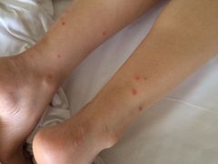 iphone_upload_pic-深圳阳光酒店