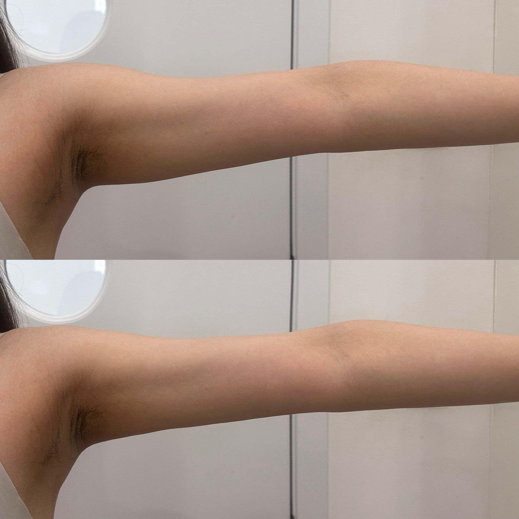 手臂线条真的有变清晰!有没有?有没有