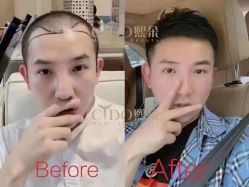 -熙朵美学植发·连锁品牌