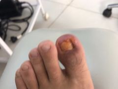 -新甲连锁灰指甲·甲沟炎·鸡眼(黑龙江路店)