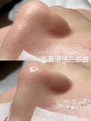 -痘院长·祛痘·科技美肤