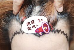 -大麦微针植发全国连锁