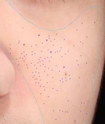 -韩国淼美颜皮肤管理官方直营店