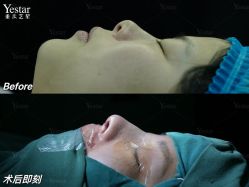 -Yestar重庆艺星医疗美容医院