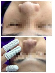 -蕾特恩专业祛痘·皮肤管理