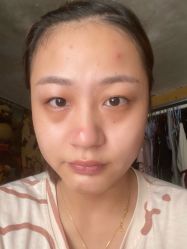 体验前-针美汇欧邦医疗美容