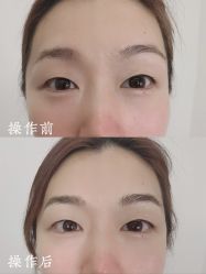 -西施无菌半永久纹绣眉眼影唇轻增发纹发际线