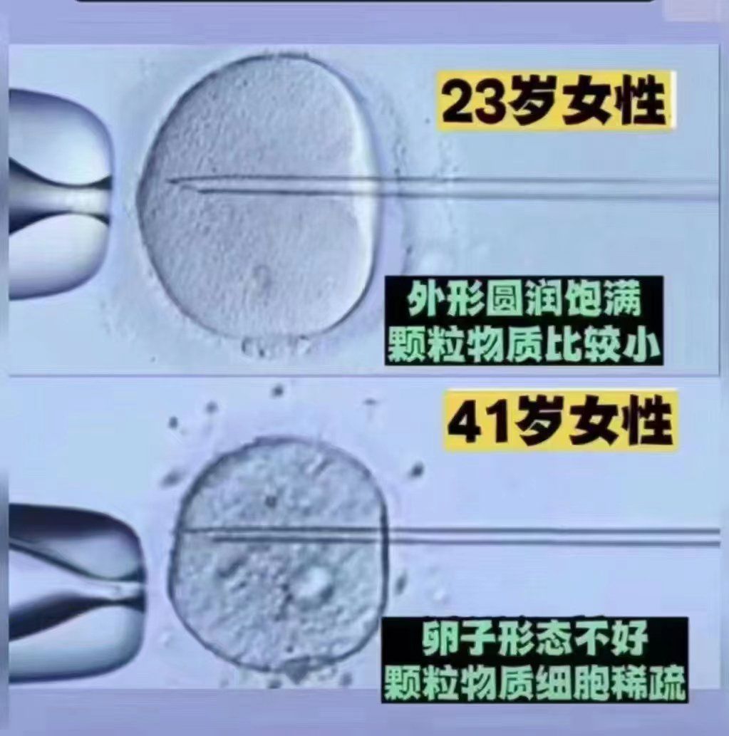 23岁的卵子和41岁的卵子对比