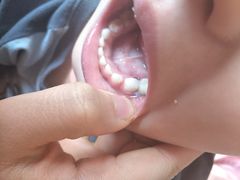 -极橙儿童齿科矫正中心(奥城店)