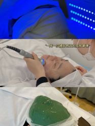 -美肤盾祛痘·问题肌头疗管理中心