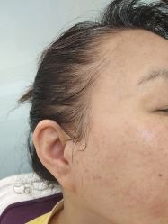 -长沙雅美医疗美容医院