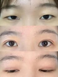 -Yestar 嘉兴艺星医疗美容医院