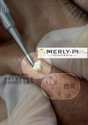 -MLP美丽派·问题肌疗愈中心