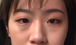 -天津健丽·去眼袋医疗美容机构