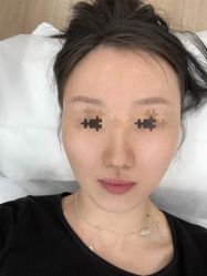 体验前-原力医疗美容