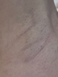 体验后-伽美医疗美容医院·高端抗衰中心