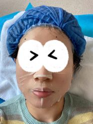 体验后-坤如玛丽·医疗美容中心