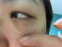 -空军总医院激光整形美容中心