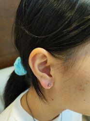 -洁铭新加坡医美