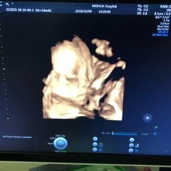 -杭州贝瑞斯美华妇儿医院·早孕·产检·儿科