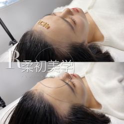 -RC半永久纹眉纹发际线