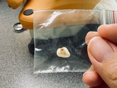 -天使口腔门诊部(上海店)