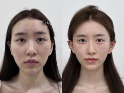 -Yestar重庆艺星医疗美容医院