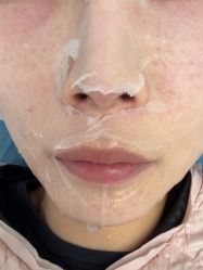 -亿美医疗美容·半岛大超炮官方授权店