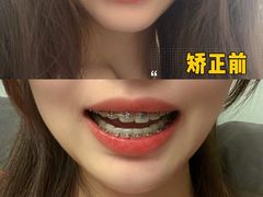 -极光口腔·矫正种植修复(锦江店)