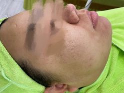 -苗医生草本科技祛痘