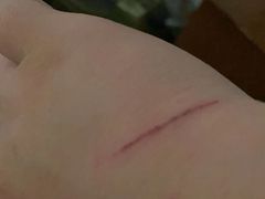 -苏州市立医院(白塔院区)