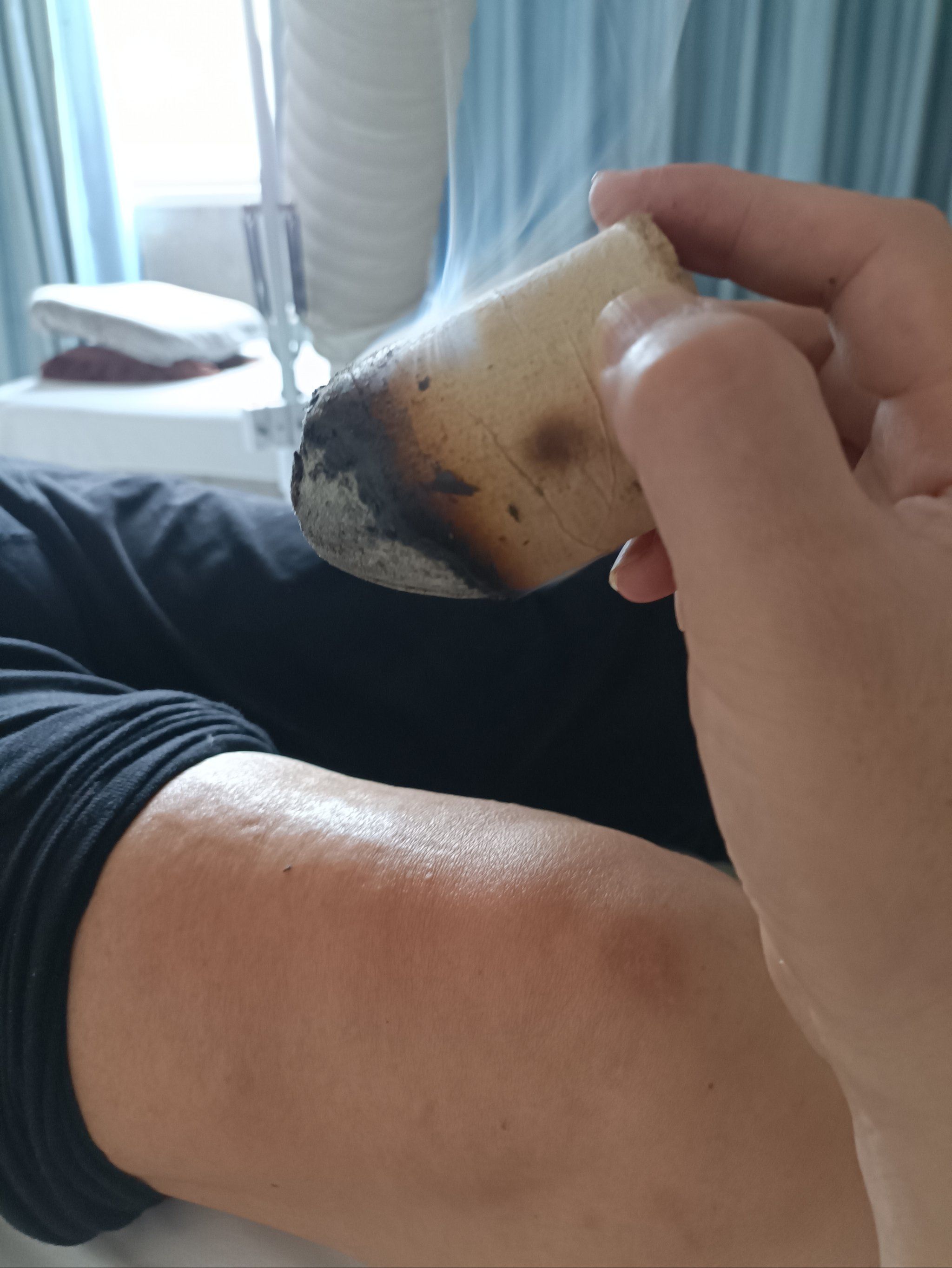 膝关节疼痛艾灸