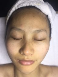-皇族养心堂·净痘·修敏·御颜