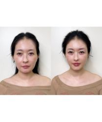 -上海伊莱美医疗美容医院